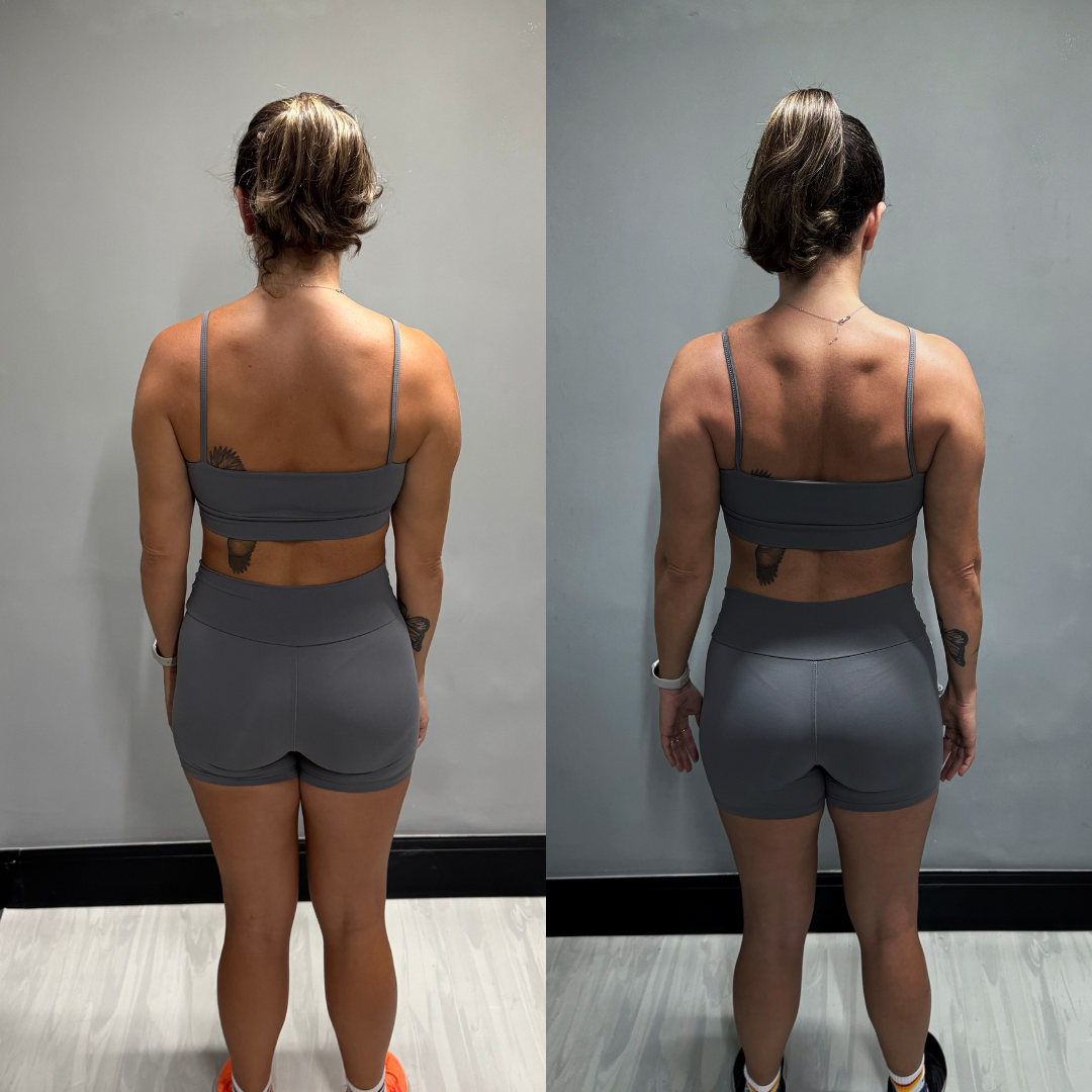 + Músculos + Definição